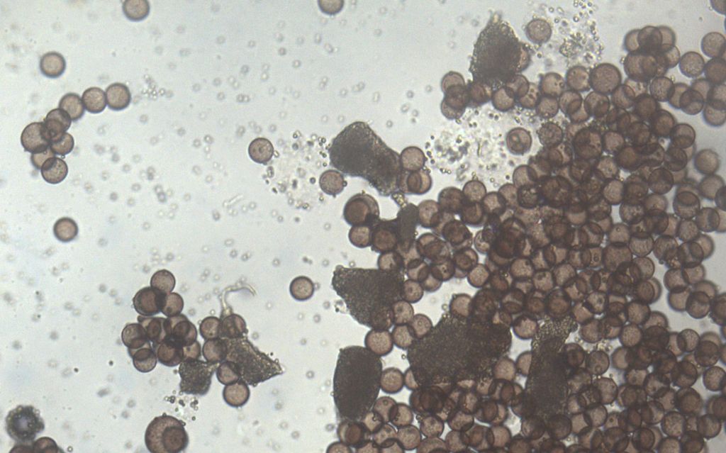 Physarum hongkongense